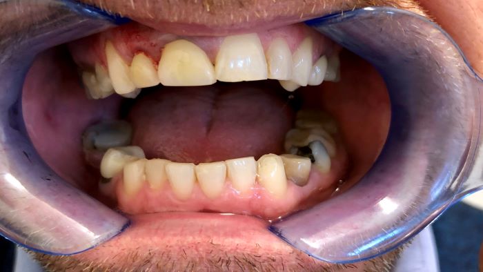 costmetic dentistry