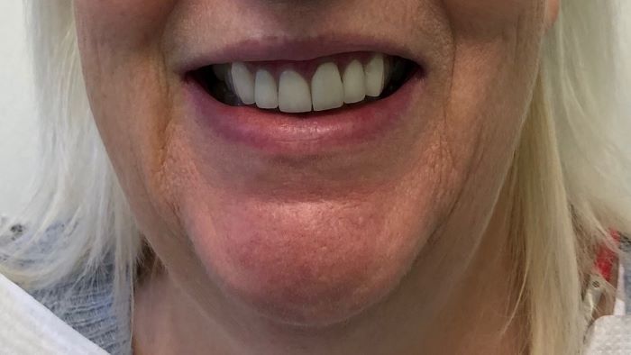 cosmetic dental surgery